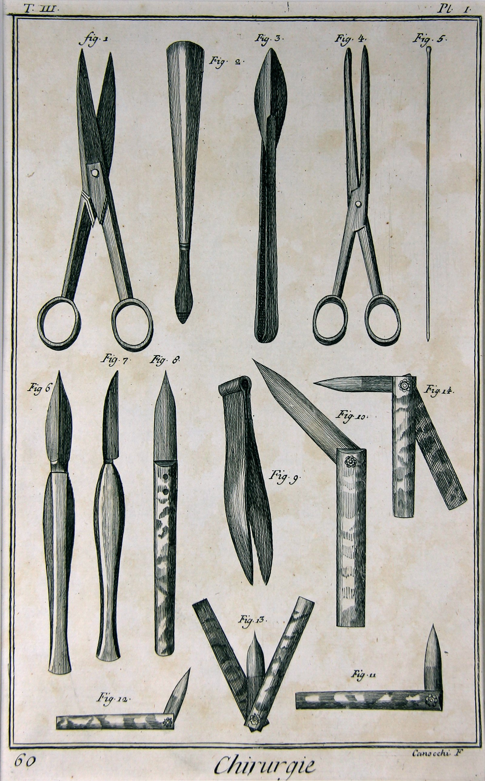 Illustration zum Kapitel Chirurgie in Diderots und d´Alemberts Encyclopédie, Pl. 01 (Wilhelm-Fabry-Museum CC BY-NC-SA)