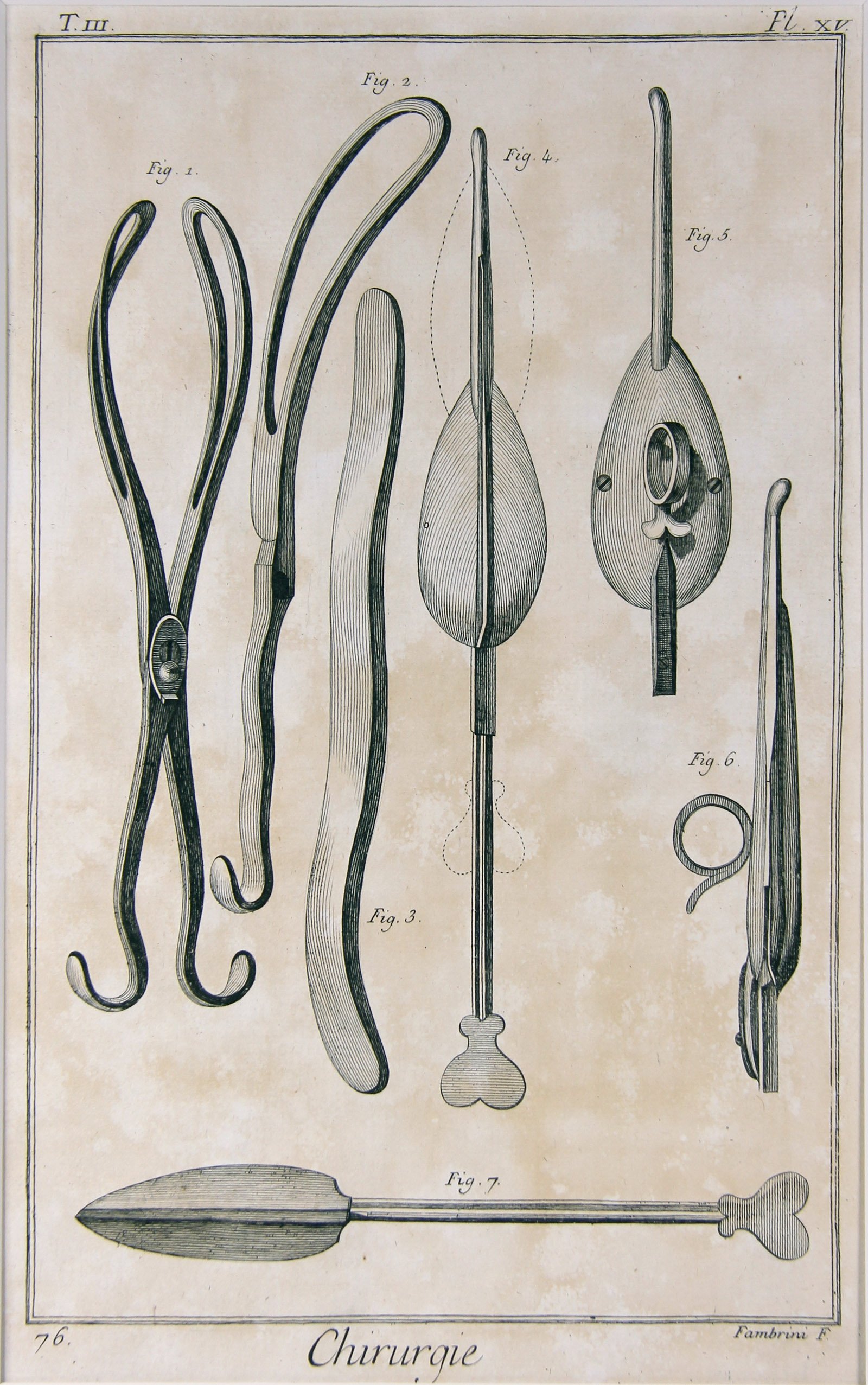Chirurgie, Pl. 15 (Wilhelm-Fabry-Museum CC BY-NC-SA)