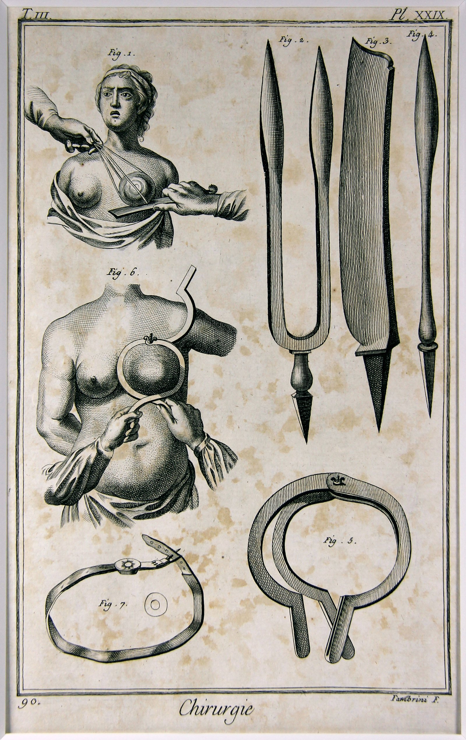 Chirurgie, Pl. 24 (Wilhelm-Fabry-Museum CC BY-NC-SA)