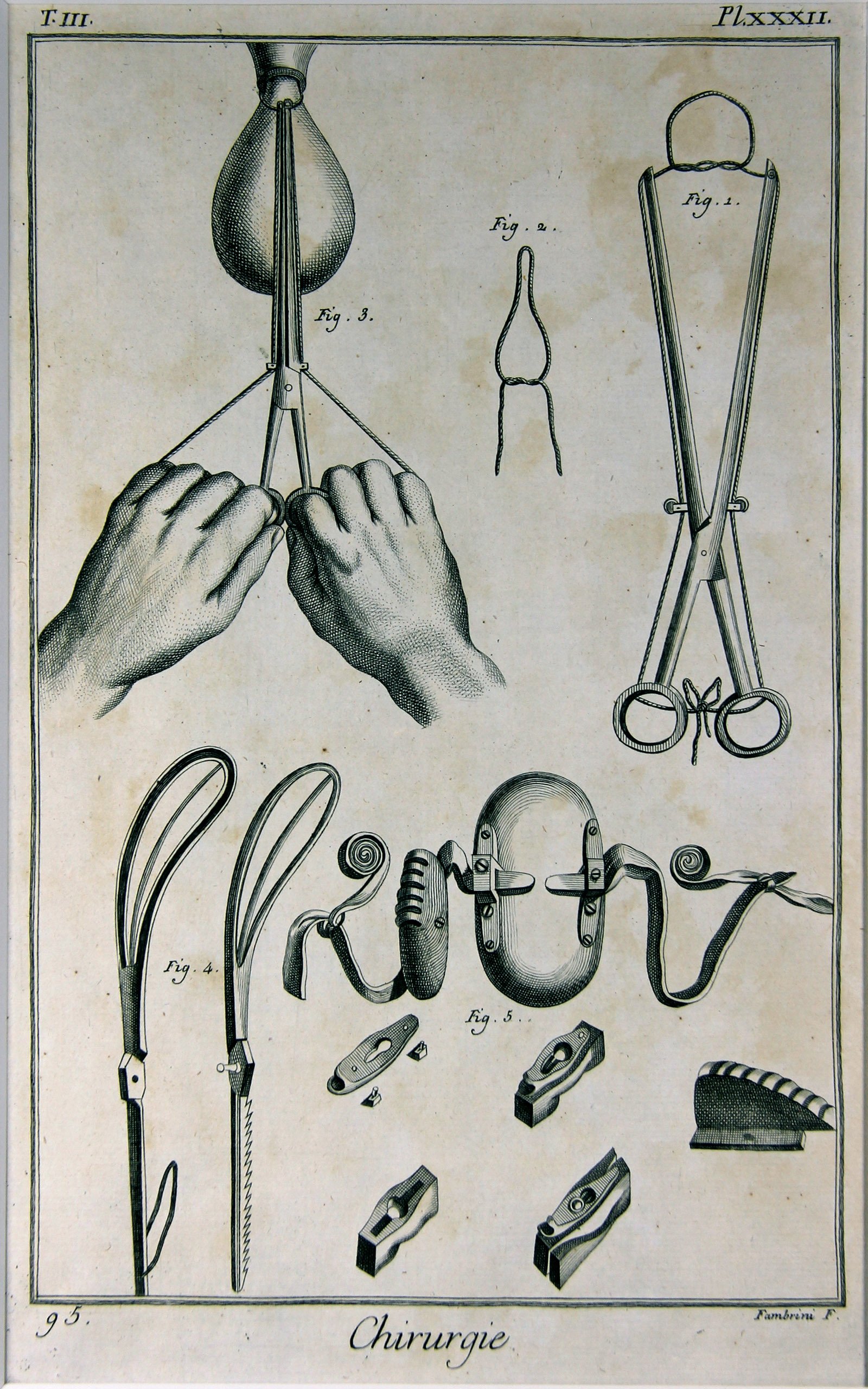 Chirurgie, Pl. 32 (Wilhelm-Fabry-Museum CC BY-NC-SA)
