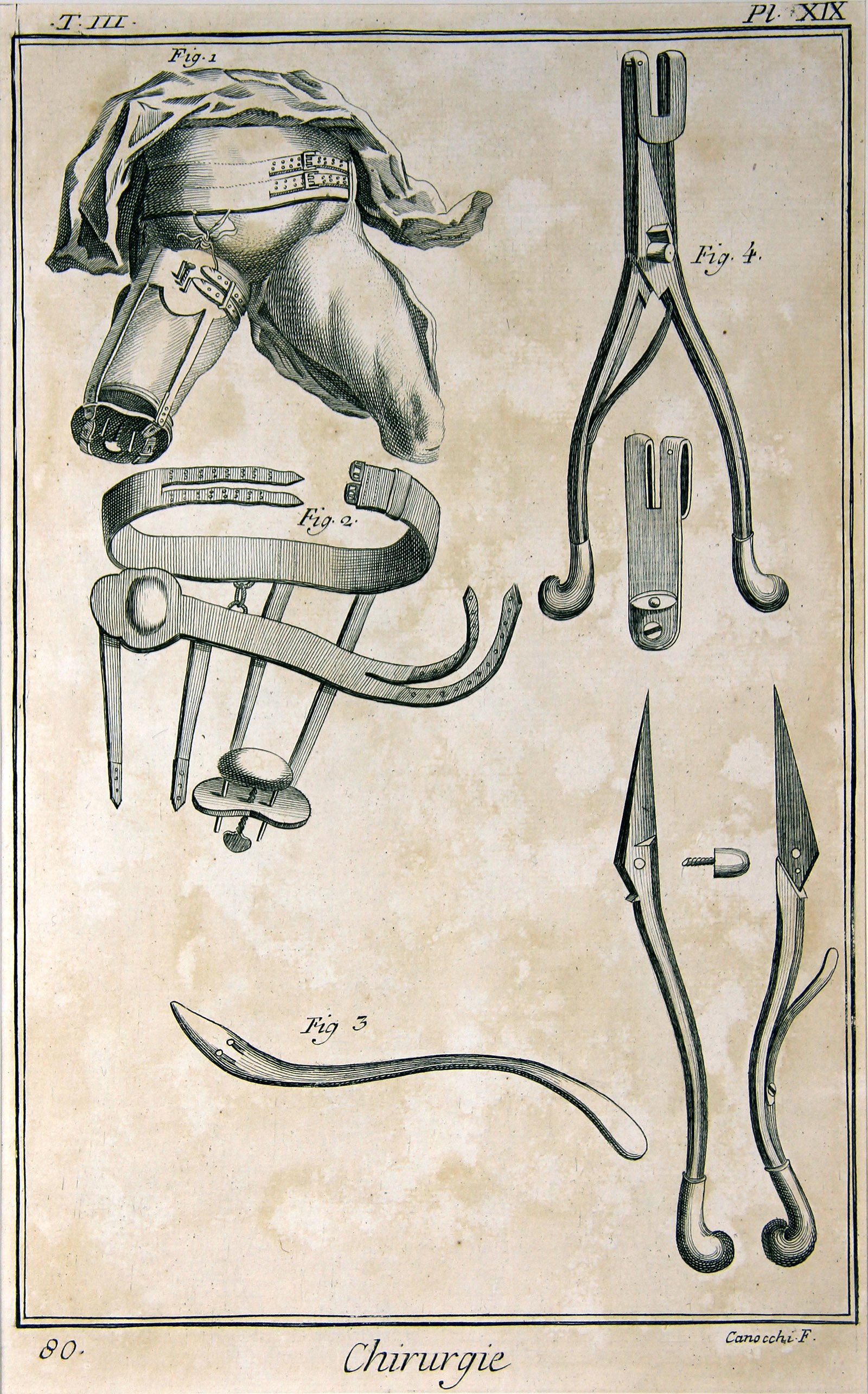 Chirurgie, Pl. 19 (Wilhelm-Fabry-Museum CC BY-NC-SA)