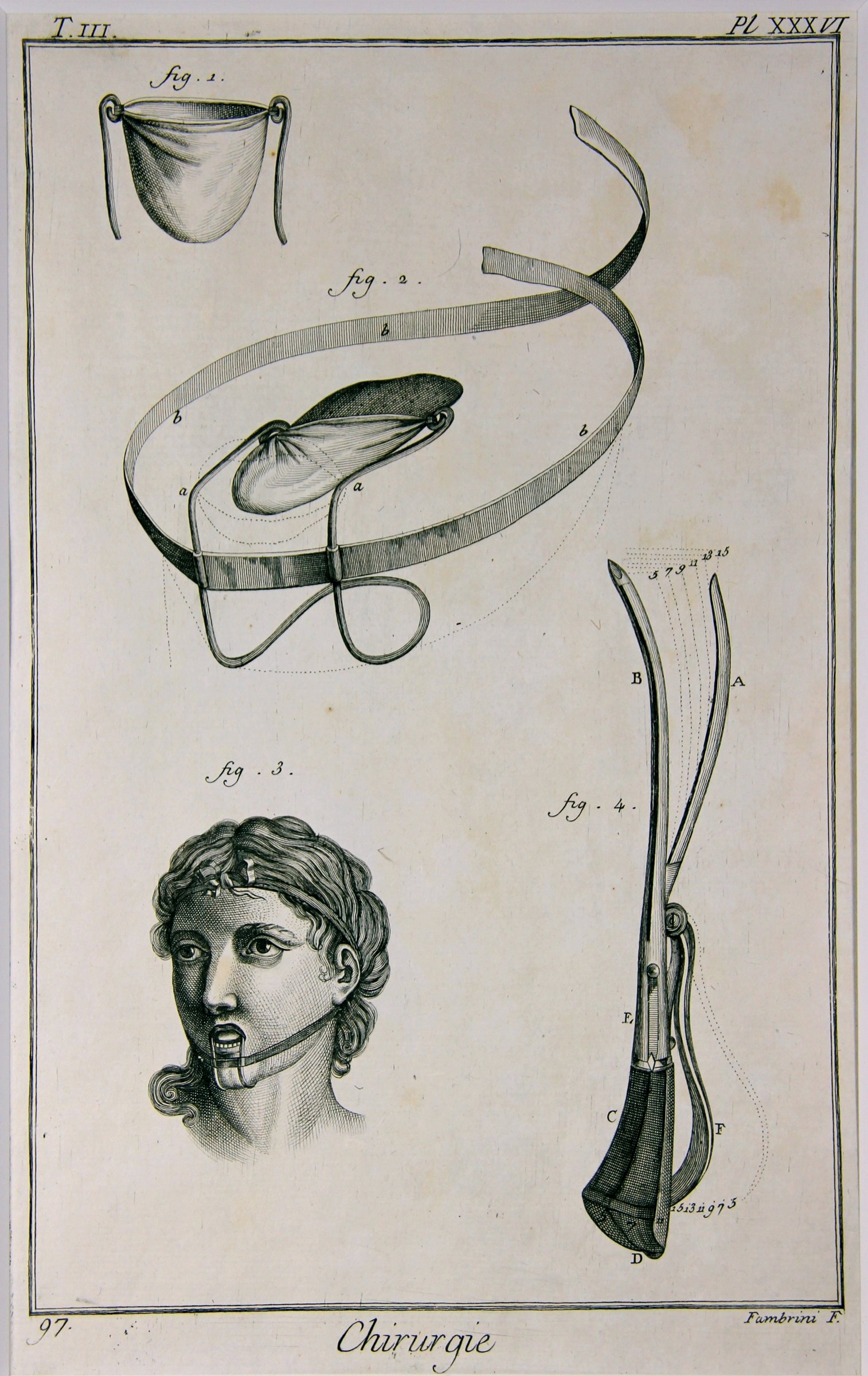 Chirurgie, Pl.36 (Wilhelm-Fabry-Museum CC BY-NC-SA)