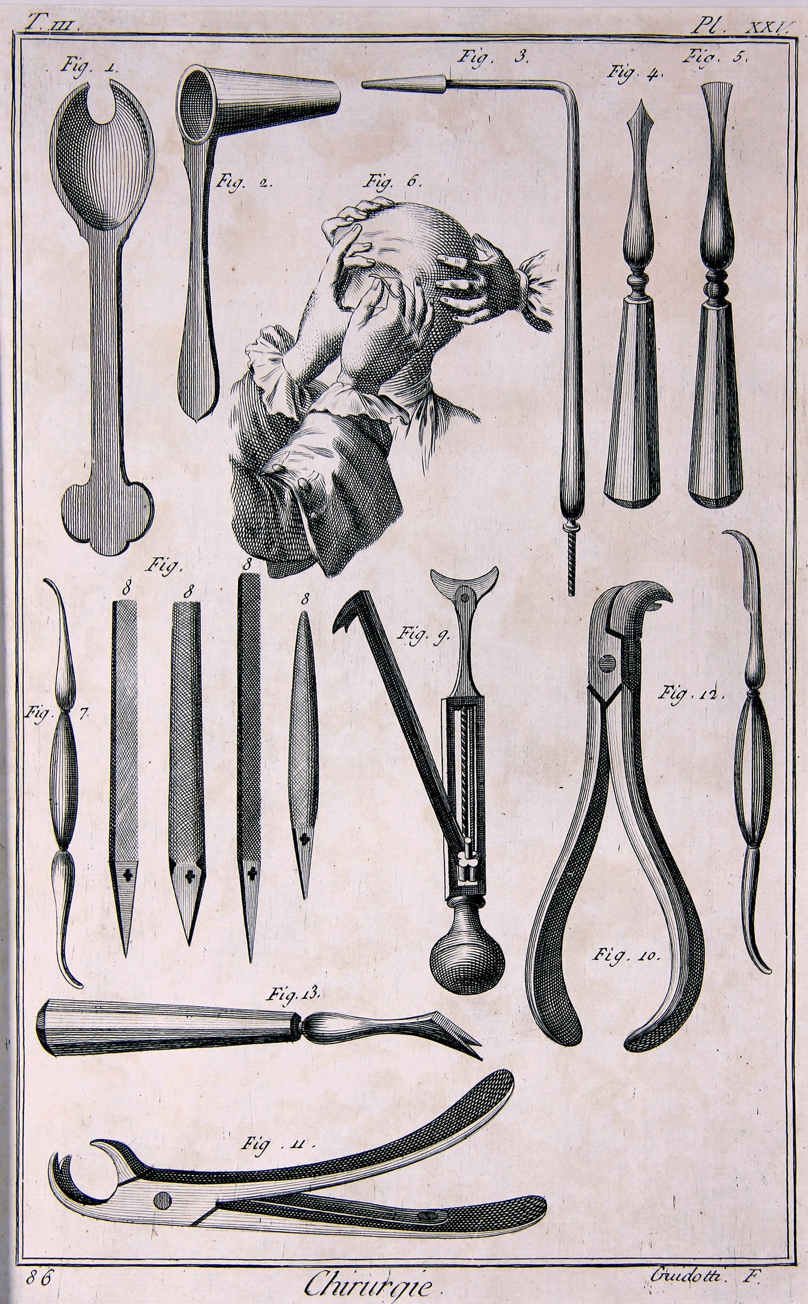Chirurgie, Pl.25 (Wilhelm-Fabry-Museum CC BY-NC-SA)