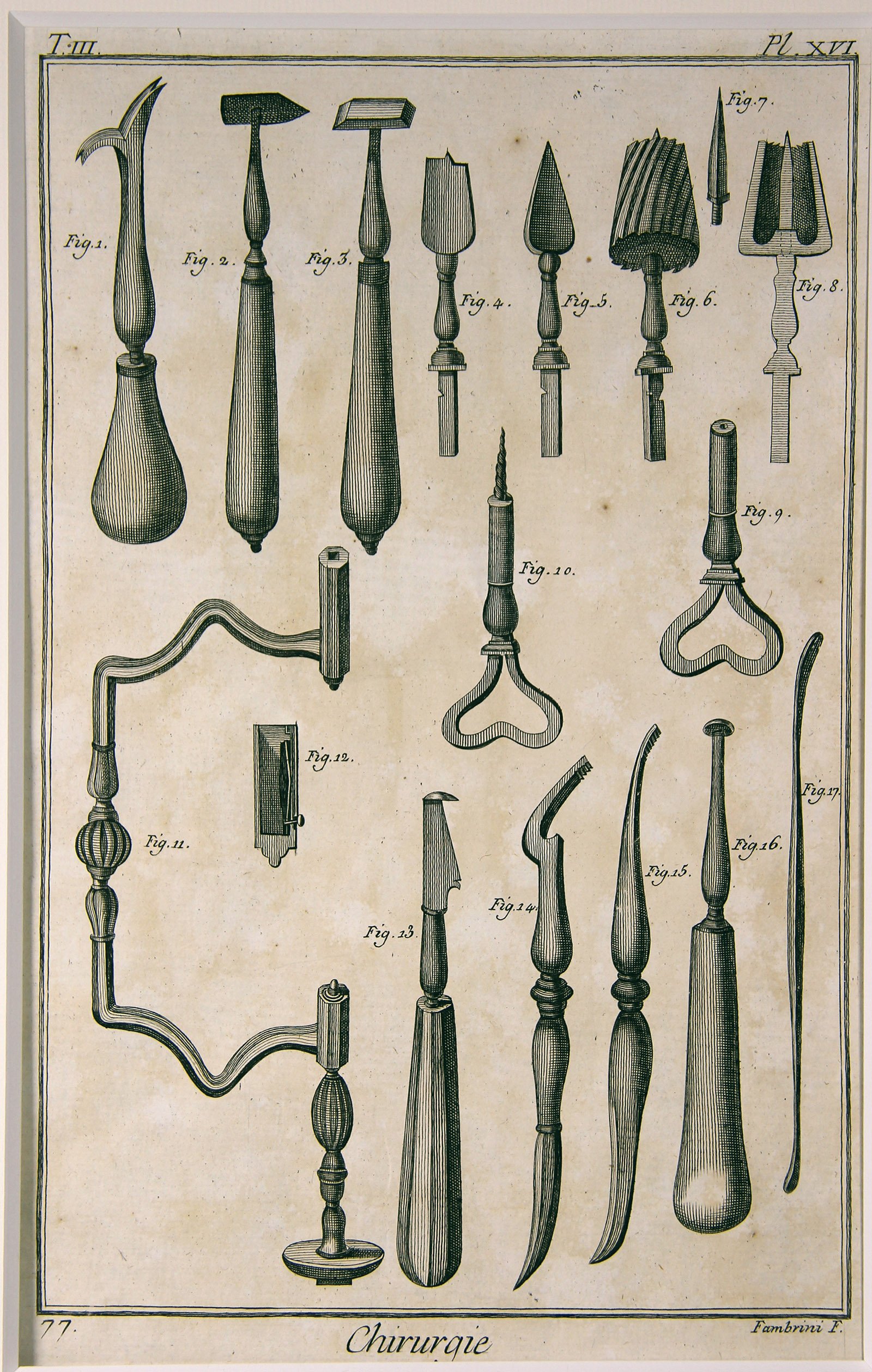 Chirurgie, Pl. 16 (Wilhelm-Fabry-Museum CC BY-NC-SA)