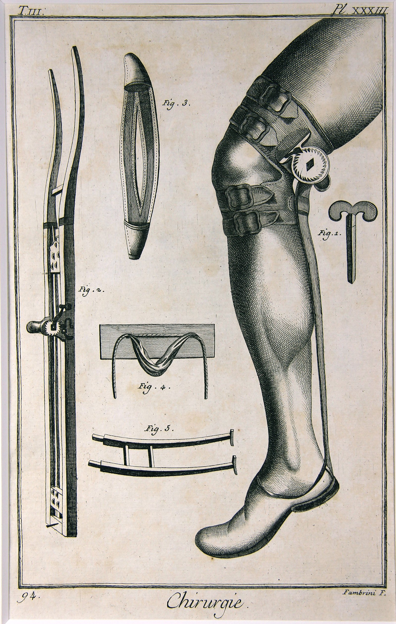 Chirurgie, Pl. 33 (Wilhelm-Fabry-Museum CC BY-NC-SA)