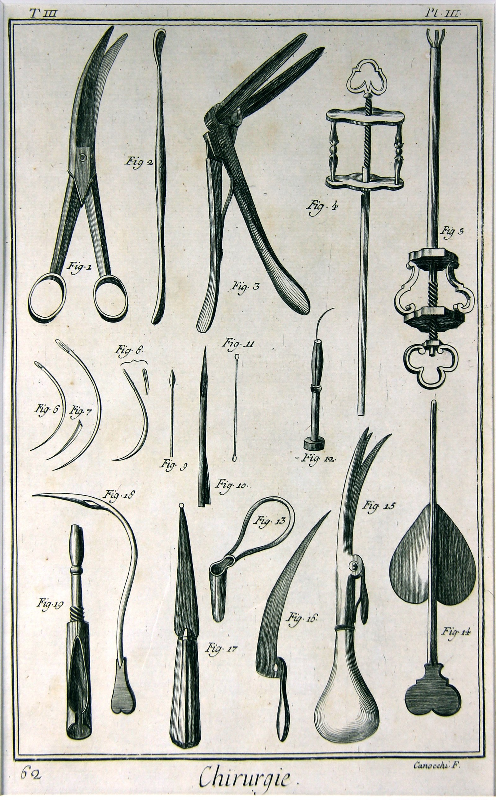 Chirurgie, Pl. 03 (Wilhelm-Fabry-Museum CC BY-NC-SA)