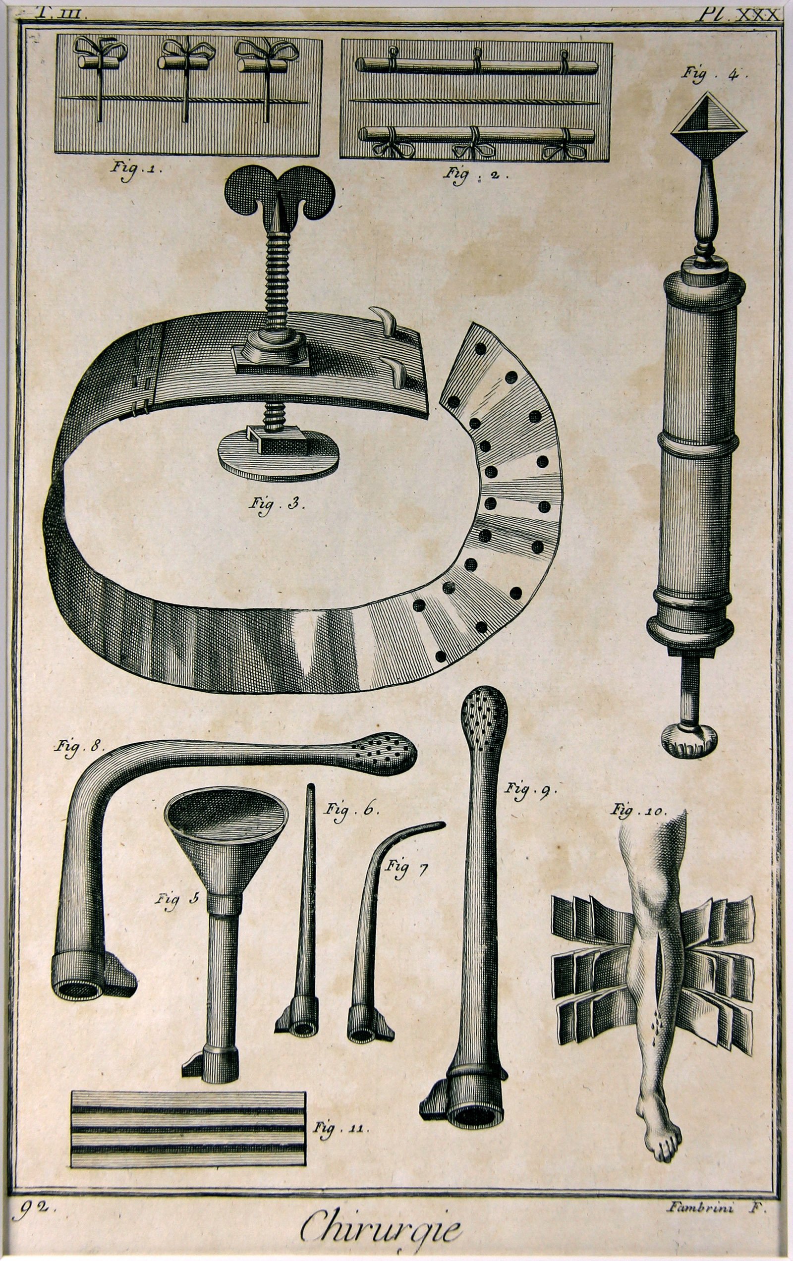 Chirurgie, Pl. 30 (Wilhelm-Fabry-Museum CC BY-NC-SA)