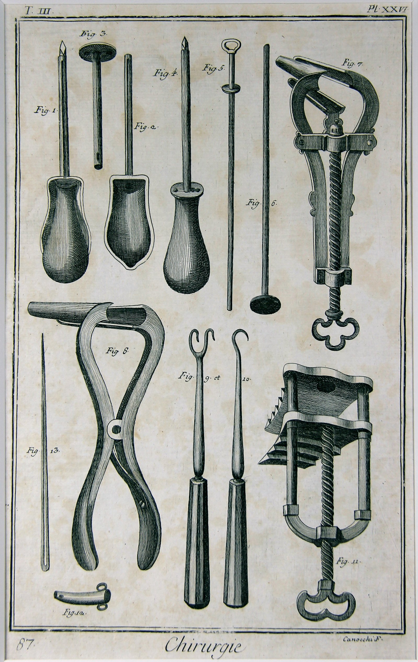 Chirurgie, Pl. 26 (Wilhelm-Fabry-Museum CC BY-NC-SA)
