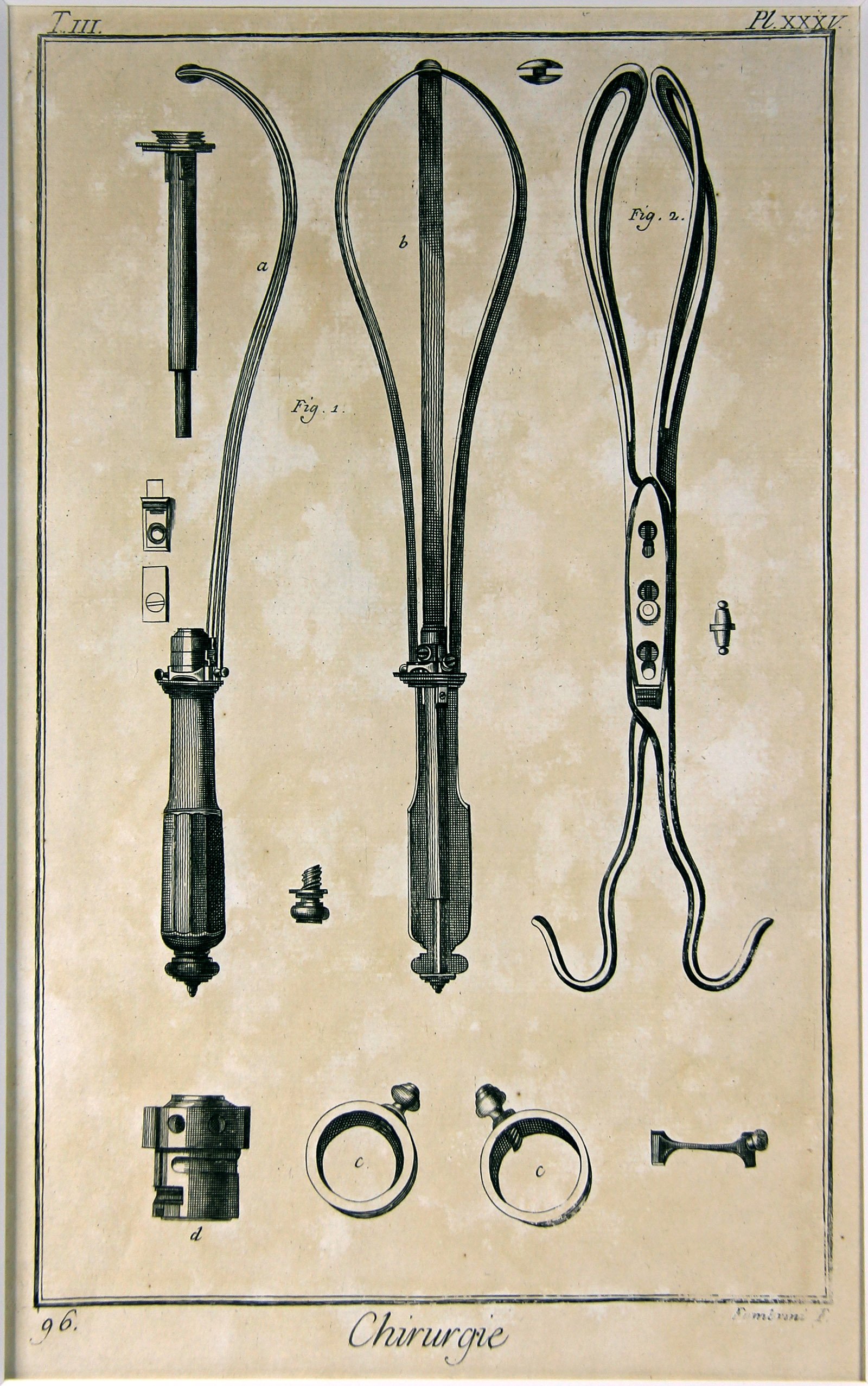 Chirurgie, Pl. 35 (Wilhelm-Fabry-Museum CC BY-NC-SA)