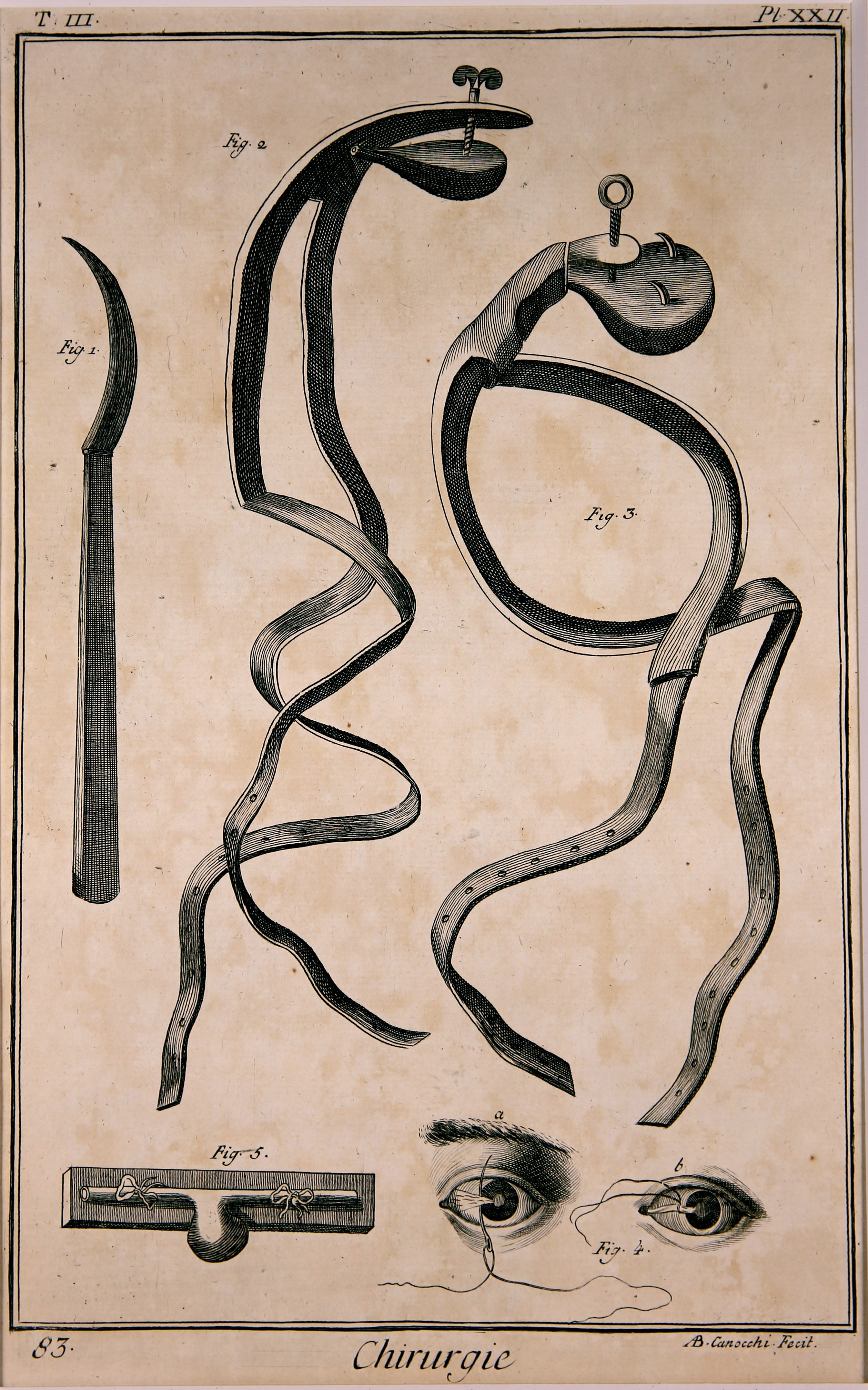 Chirurgie, Pl. 22 (Wilhelm-Fabry-Museum CC BY-NC-SA)