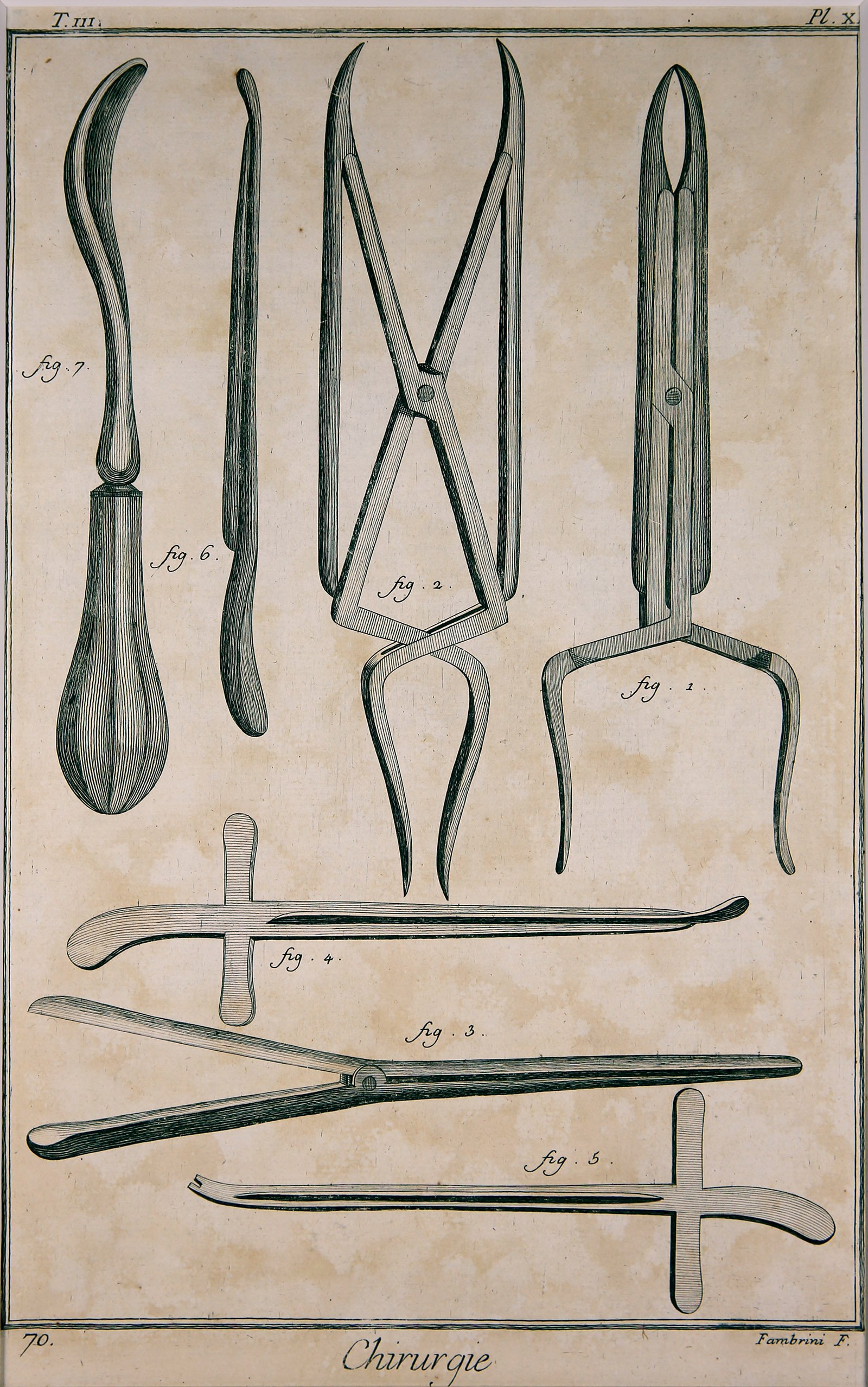 Chirurgie, Pl. 11 (Wilhelm-Fabry-Museum CC BY-NC-SA)