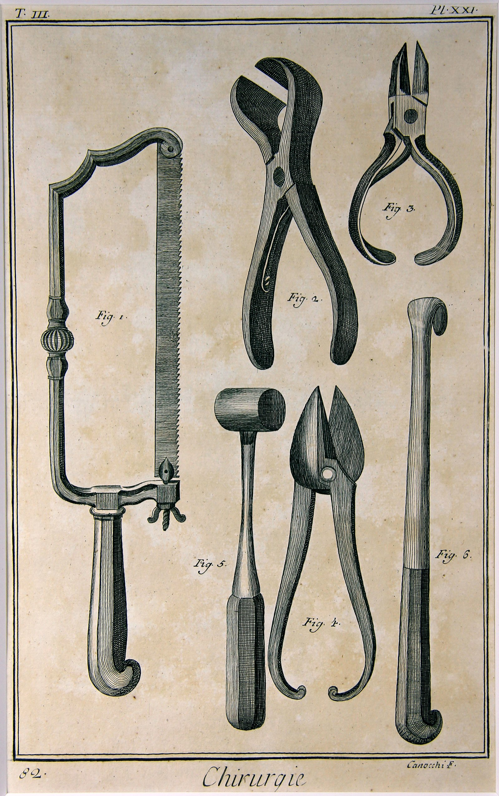 Chirurgie, Pl. 21 (Wilhelm-Fabry-Museum CC BY-NC-SA)