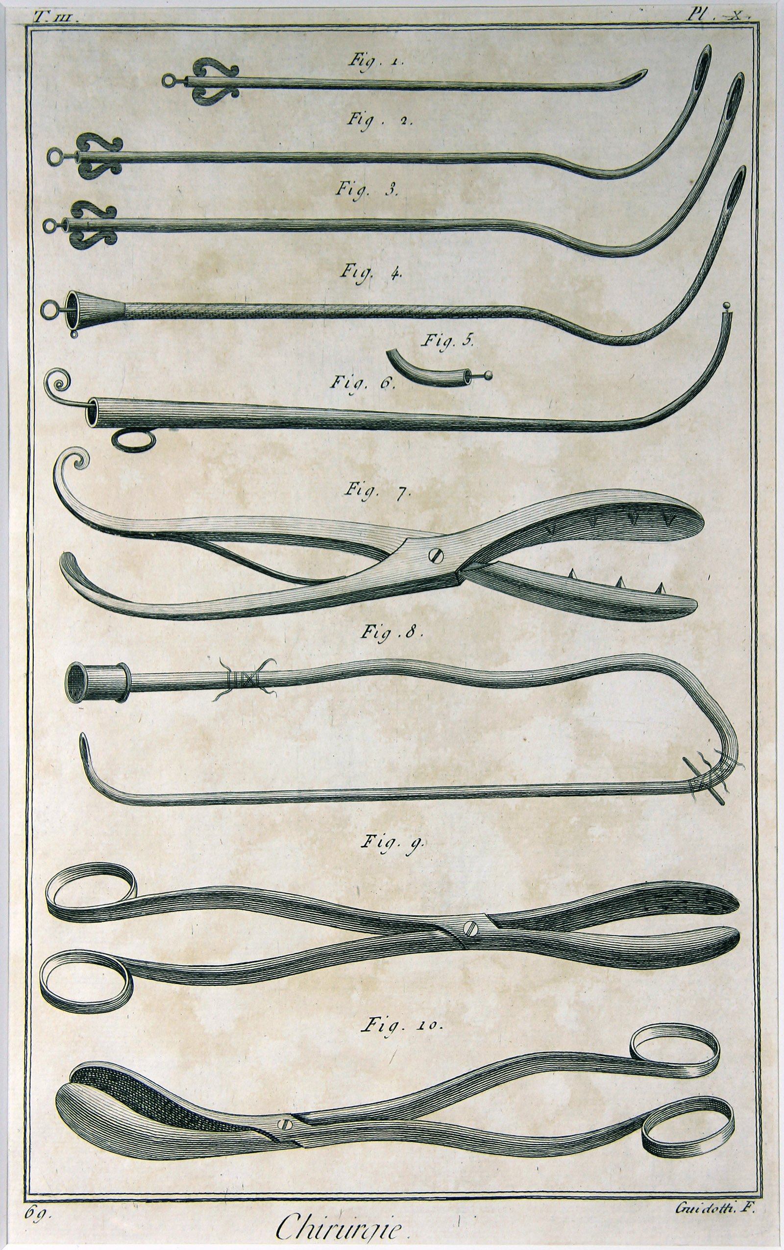 Chirurgie, Pl. 10 (Wilhelm-Fabry-Museum CC BY-NC-SA)