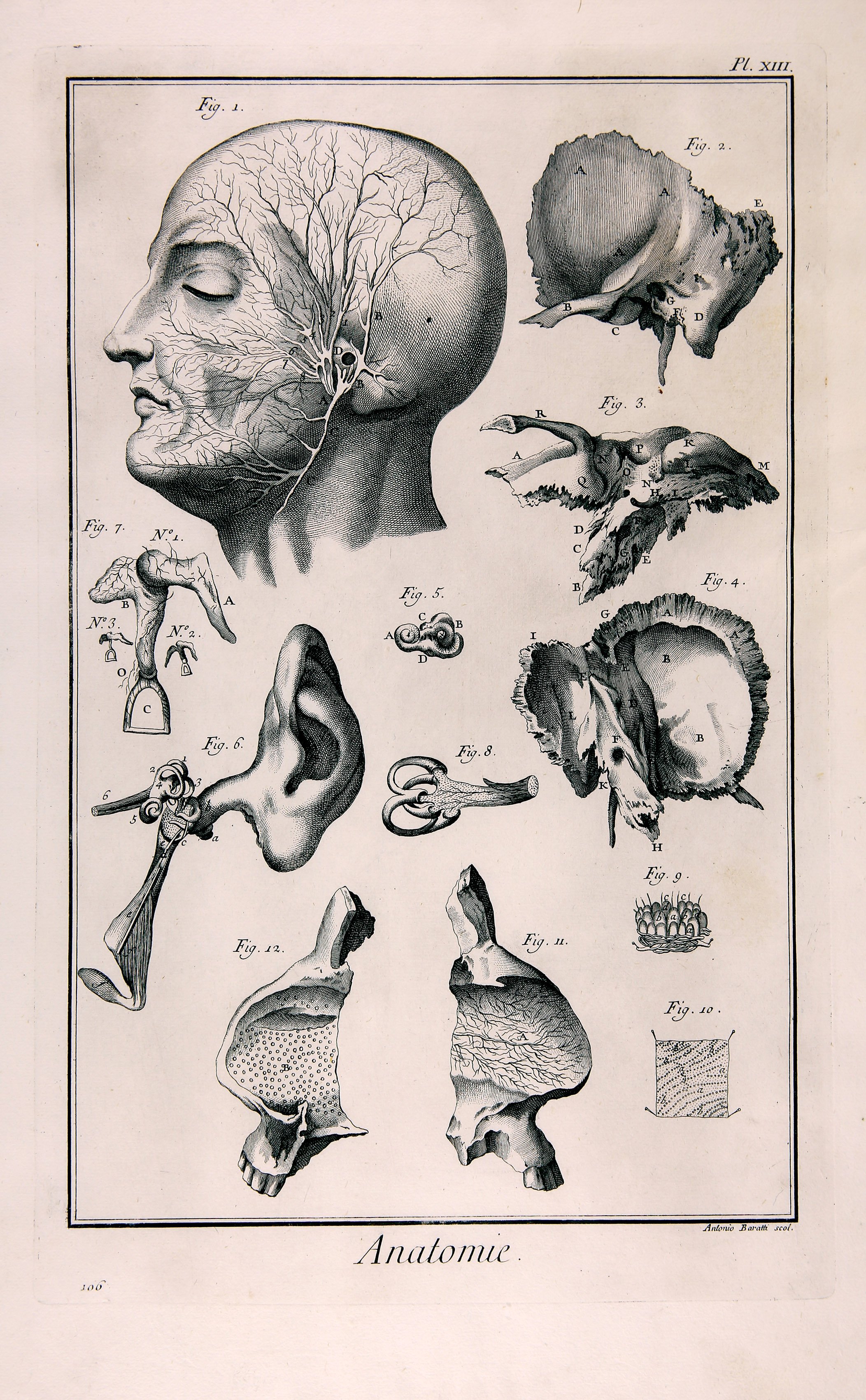 Anatomie, Pl. XIII (Wilhelm-Fabry-Museum CC BY-NC-SA)