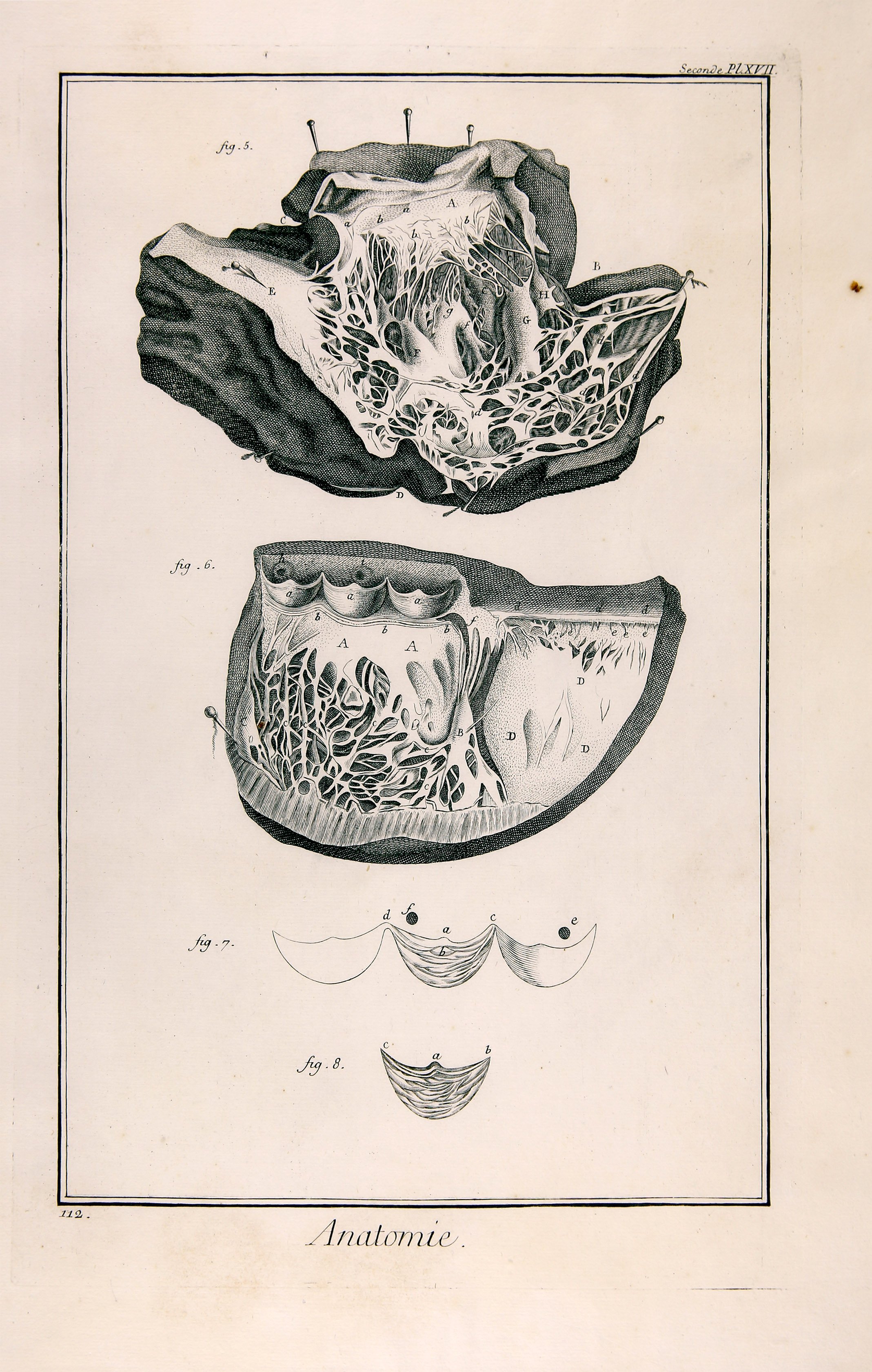 Anatomie, Seconde Pl. XVII (Wilhelm-Fabry-Museum CC BY-NC-SA)