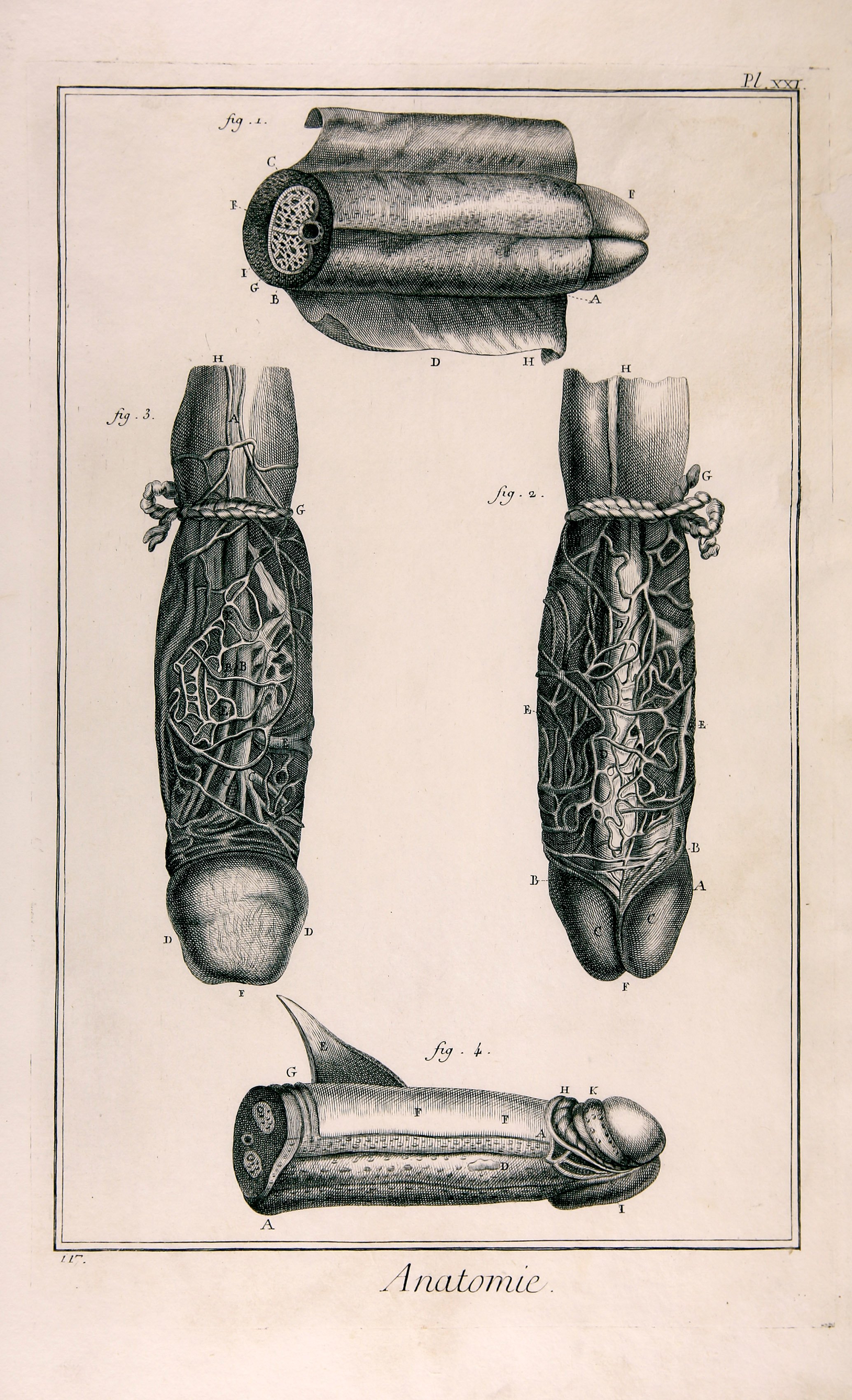 Anatomie, Pl. XXI (Wilhelm-Fabry-Museum CC BY-NC-SA)