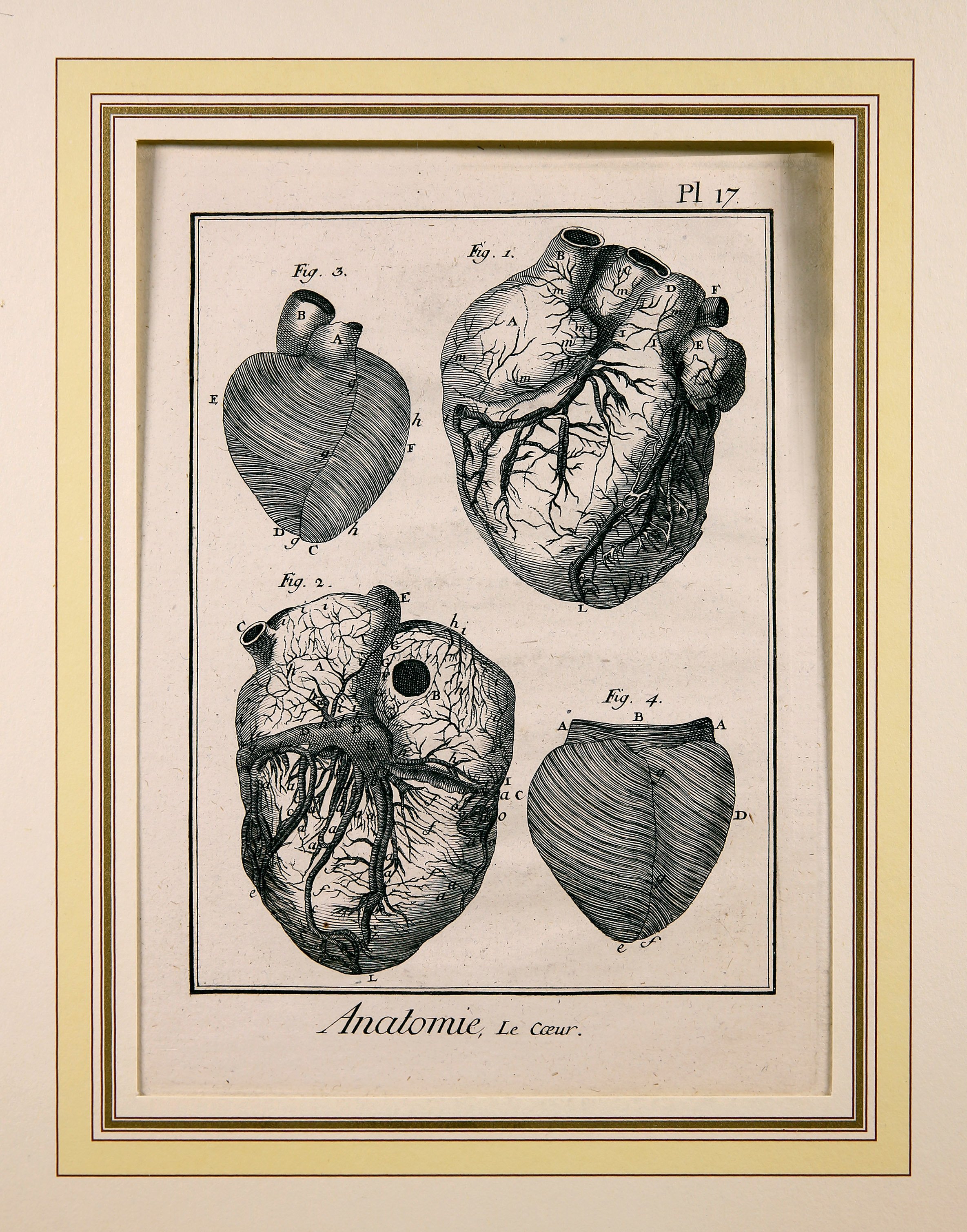 Anatomie, Pl.17 (Wilhelm-Fabry-Museum CC BY-NC-SA)