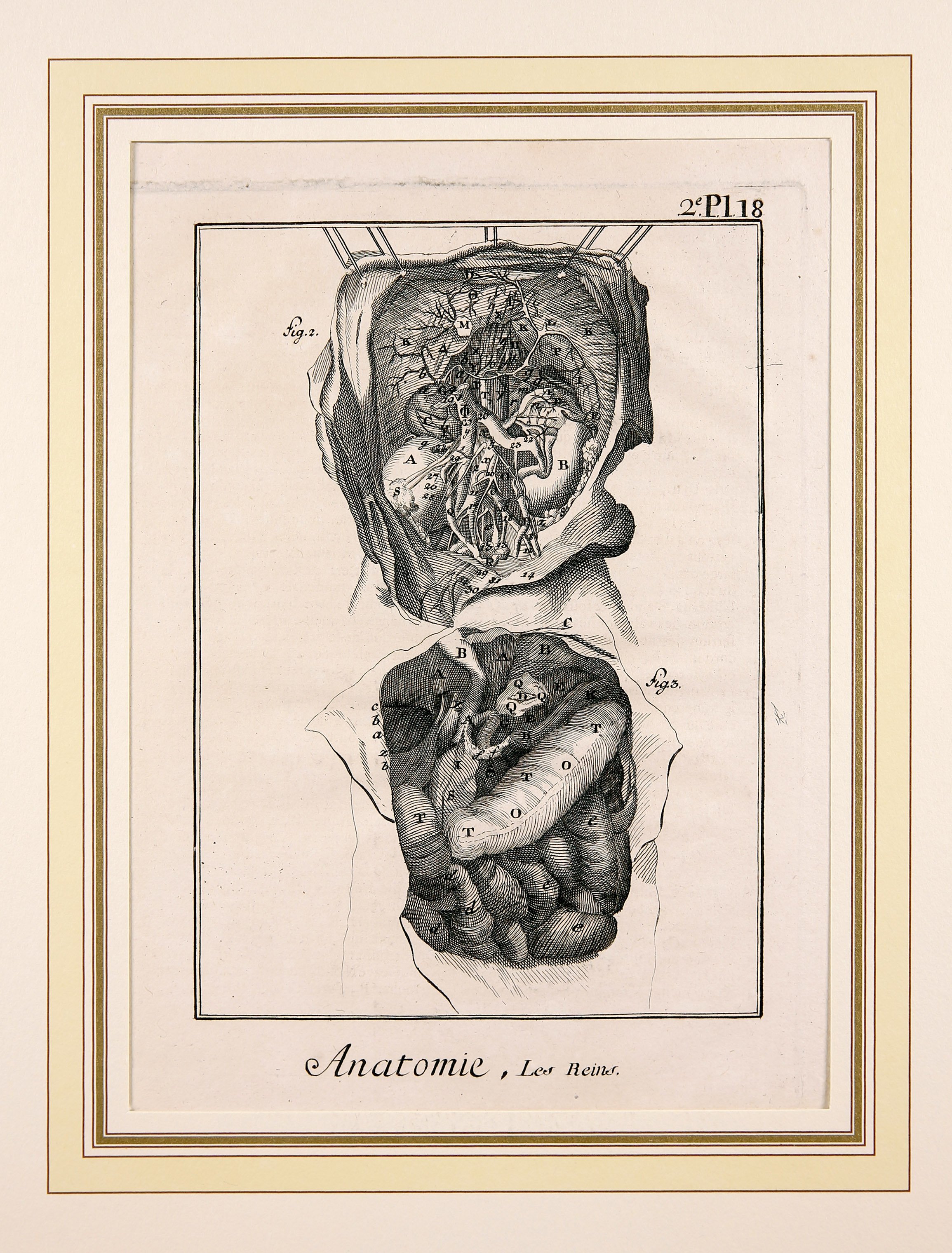 Anatomie, Seconde Pl.18 (Wilhelm-Fabry-Museum CC BY-NC-SA)