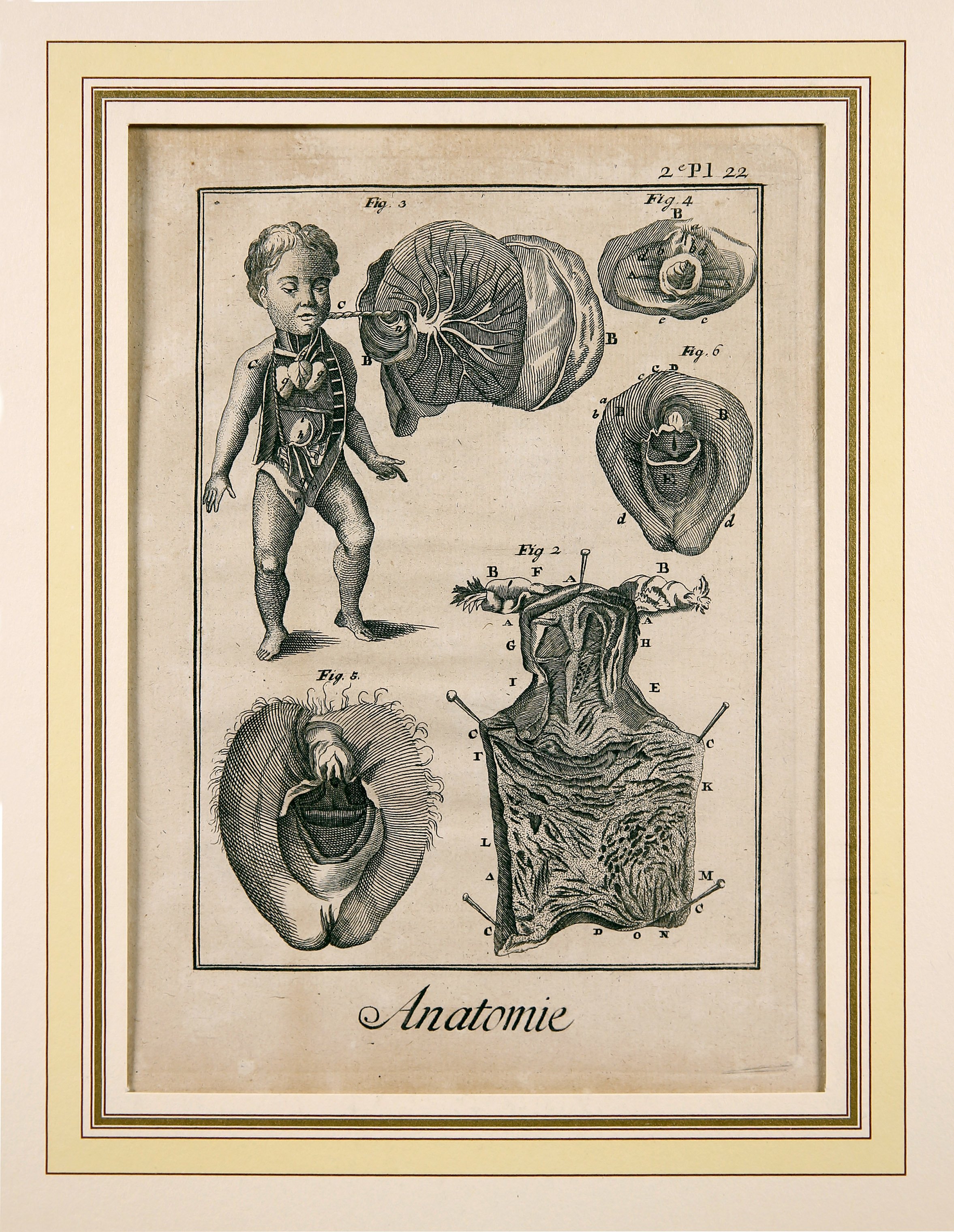 Anatomie, deuxième Pl. 22 (Wilhelm-Fabry-Museum CC BY-NC-SA)