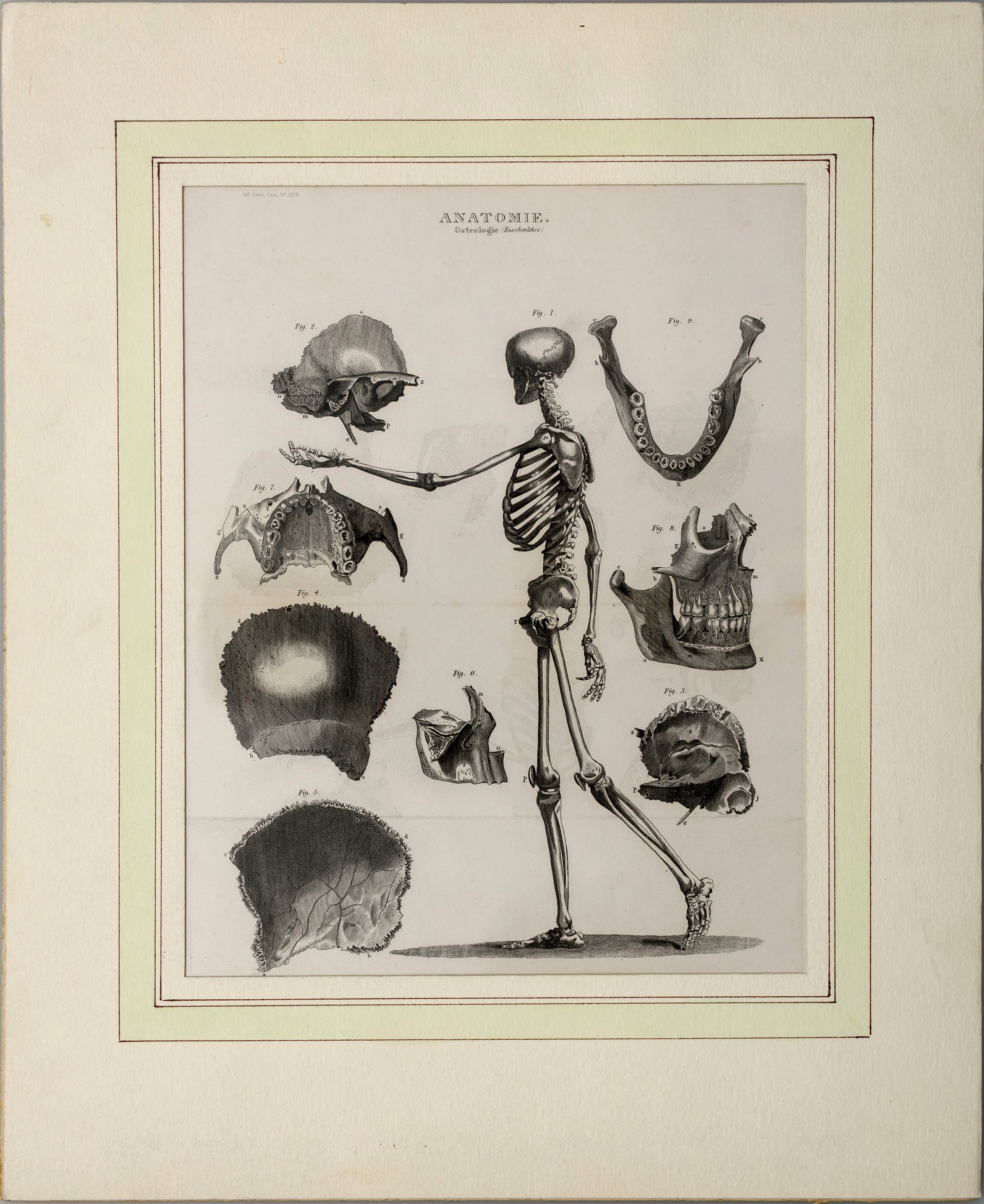 Seite aus Meyers Conversationslexikon, Anatomie Osteologie (Wilhelm-Fabry-Museum CC BY-NC-SA)