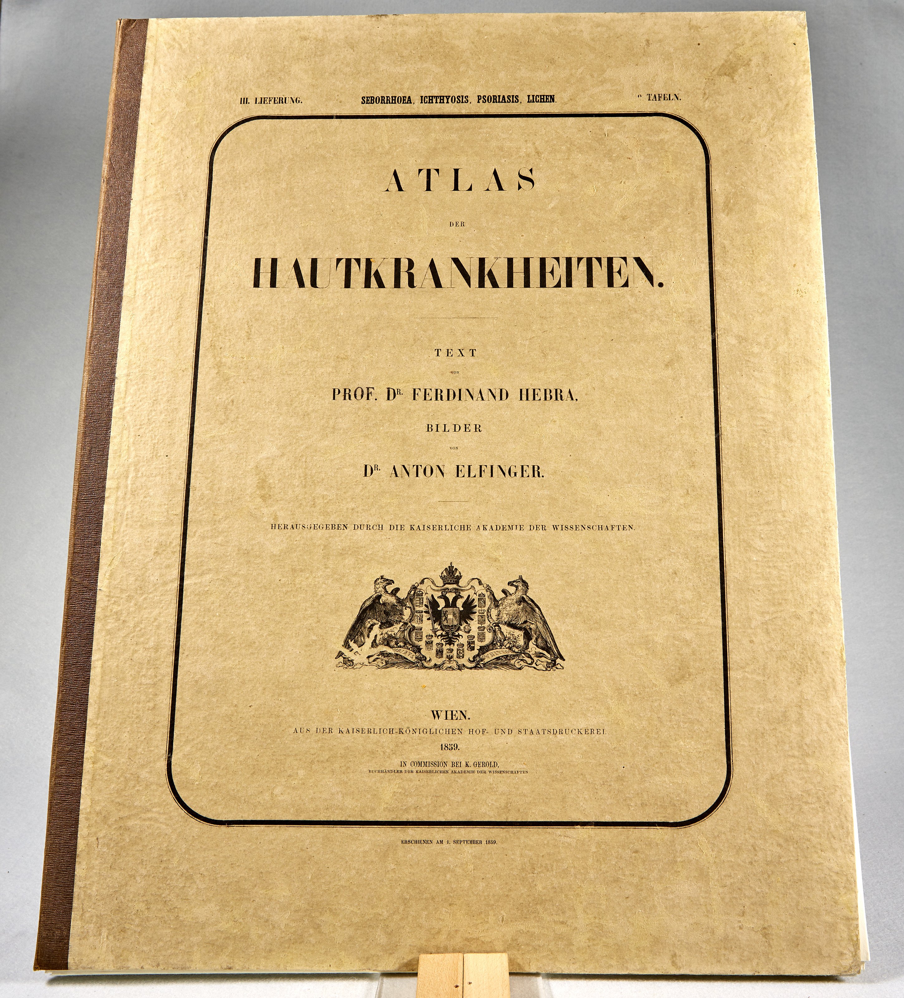 Hebra/ Elfinger: Atlas der Hautkrankheiten, III.Lieferung (Wilhelm-Fabry-Museum CC BY-NC-SA)