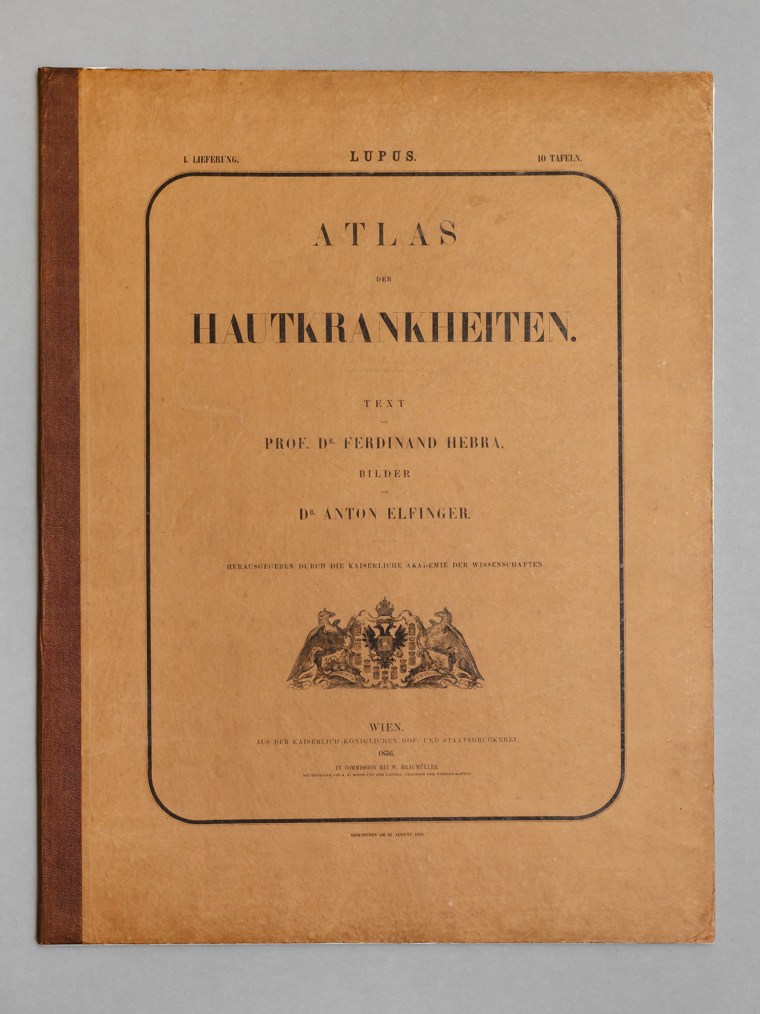 Hebra, Elfinger: Atlas der Hautkrankheiten, I. Lieferung (Wilhelm-Fabry-Museum CC BY-NC-SA)