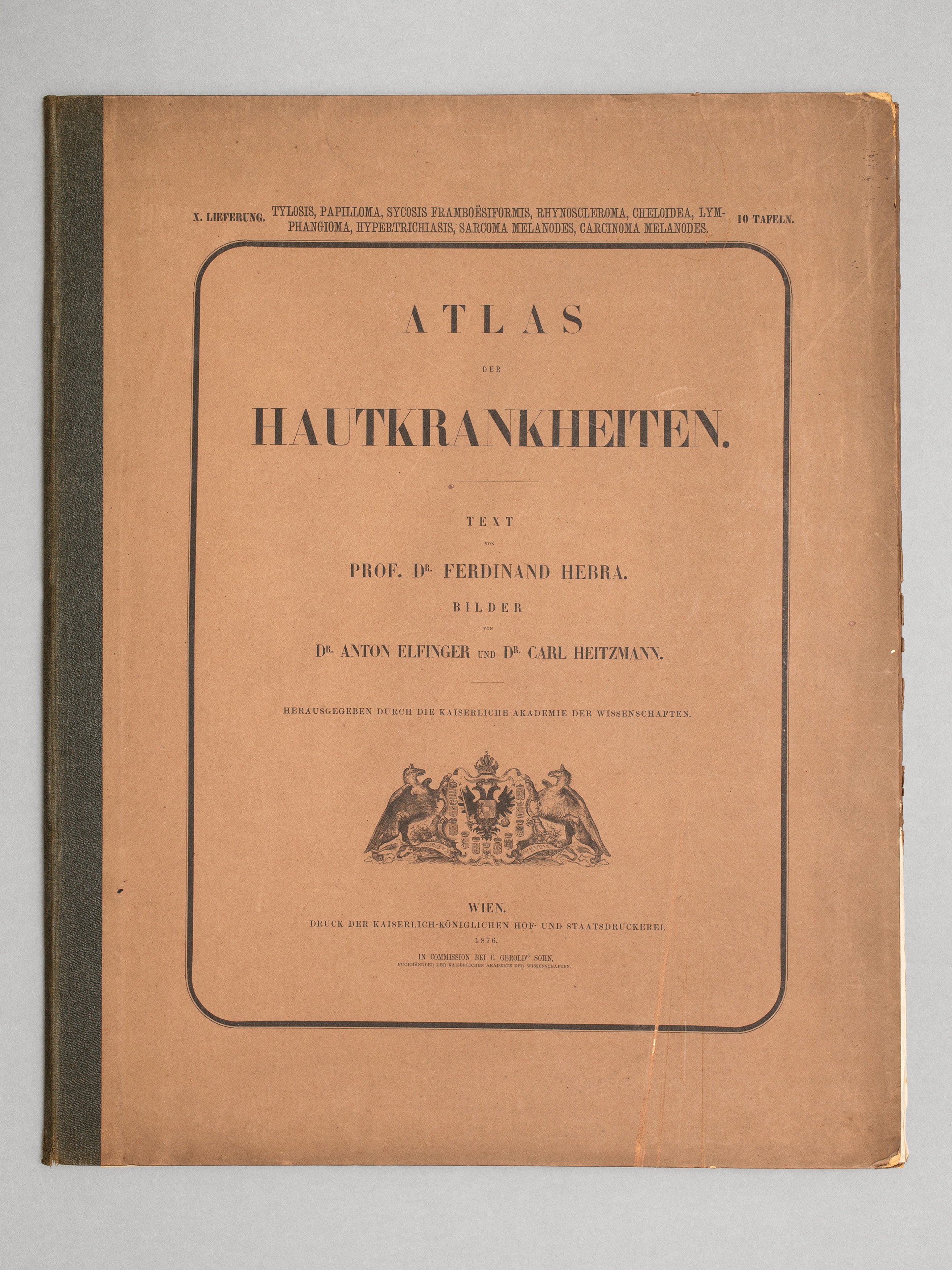 Hebra/ Elfinger: Atlas der Hautkrankheiten, X.Lieferung (Wilhelm-Fabry-Museum CC BY-NC-SA)