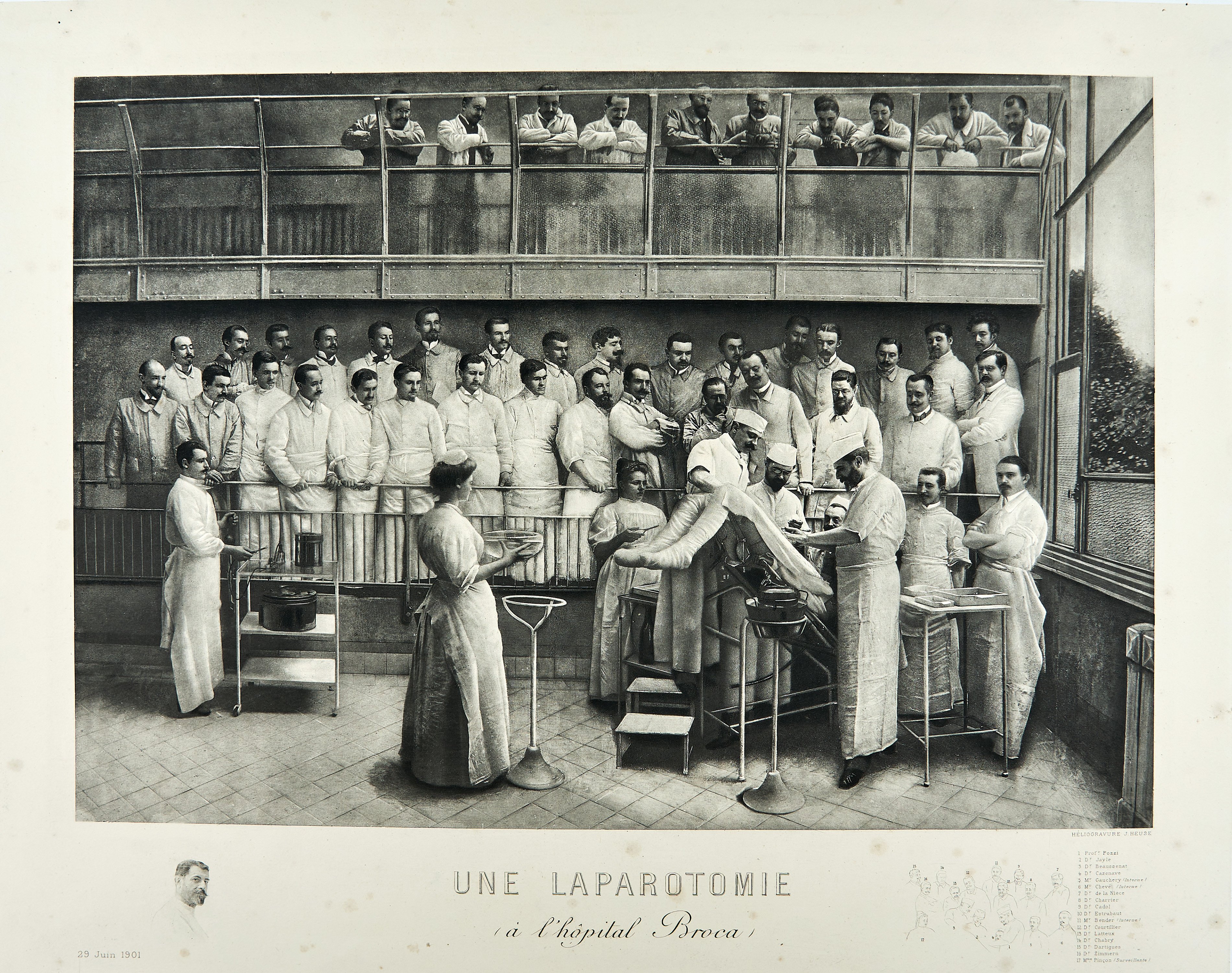 J. Heuse: Une laparotomie (a l'hopital Broca) (Wilhelm-Fabry-Museum CC BY-NC-SA)