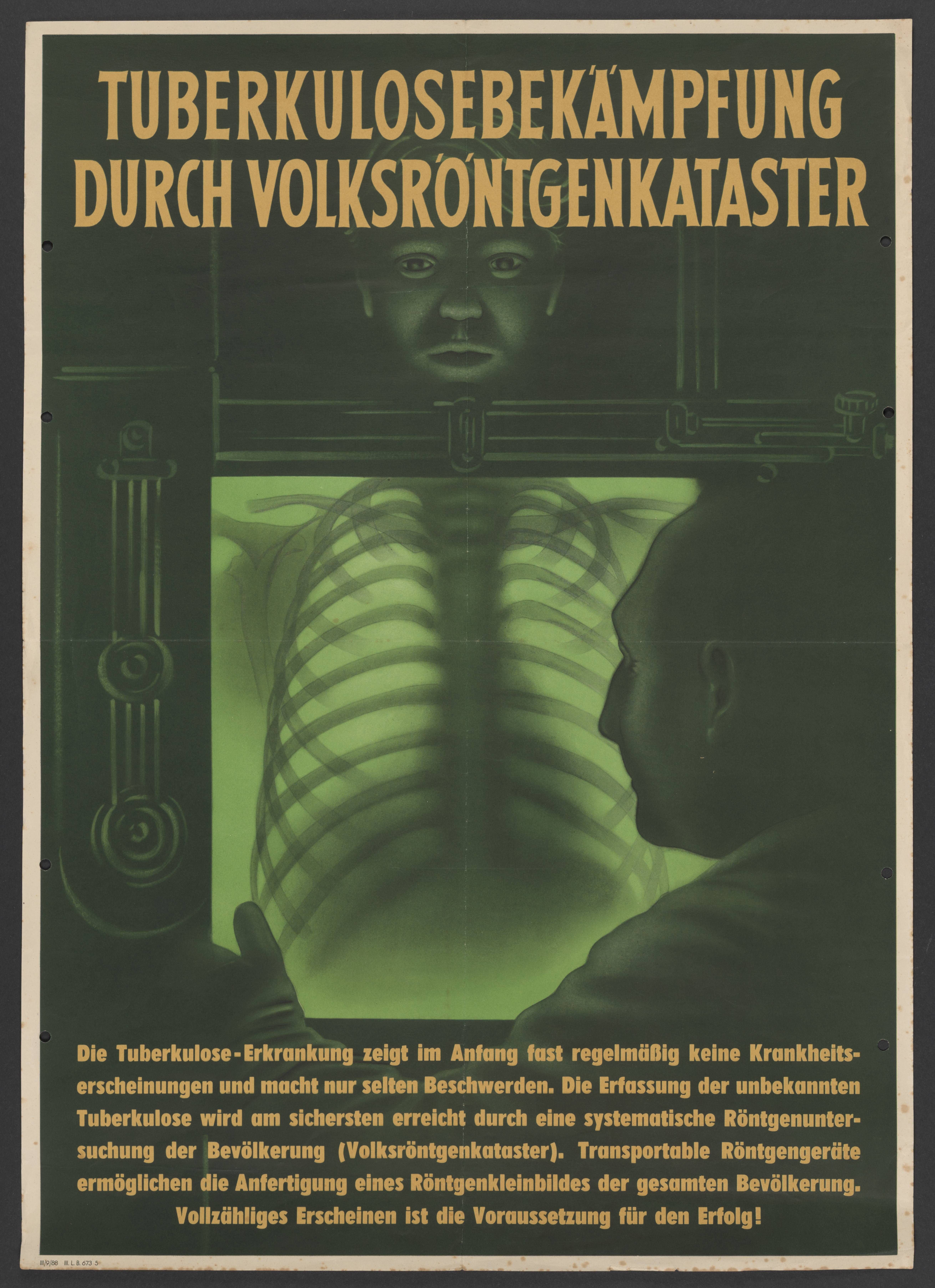 Plakat "Volksröntgenkataster" (Stadtmuseum / Kleine Galerie Döbeln CC BY-NC-SA)