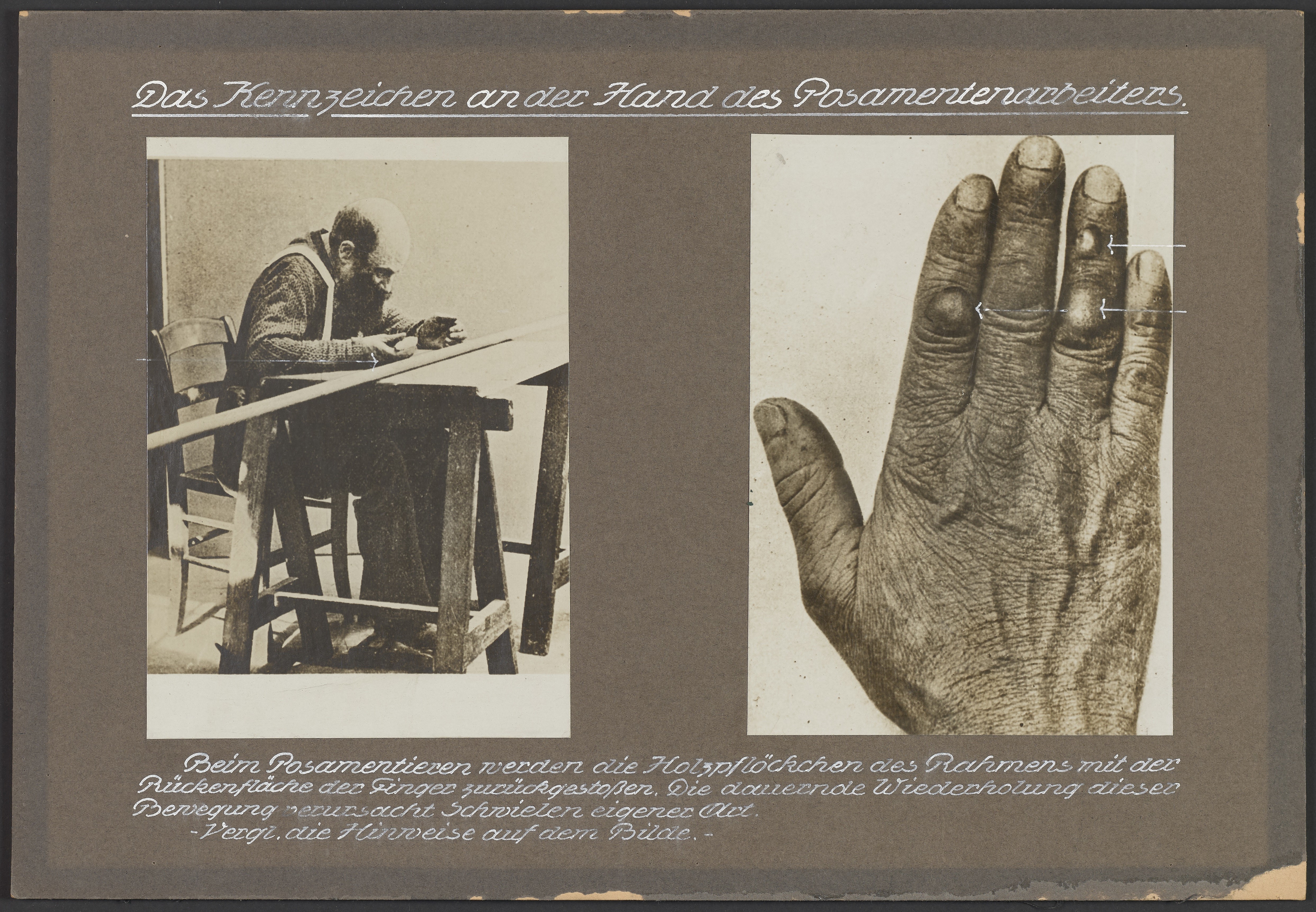 Lehrtafel "Die Hand des Posamentenarbeiters" (Polizeidirektion Dresden RR-F)