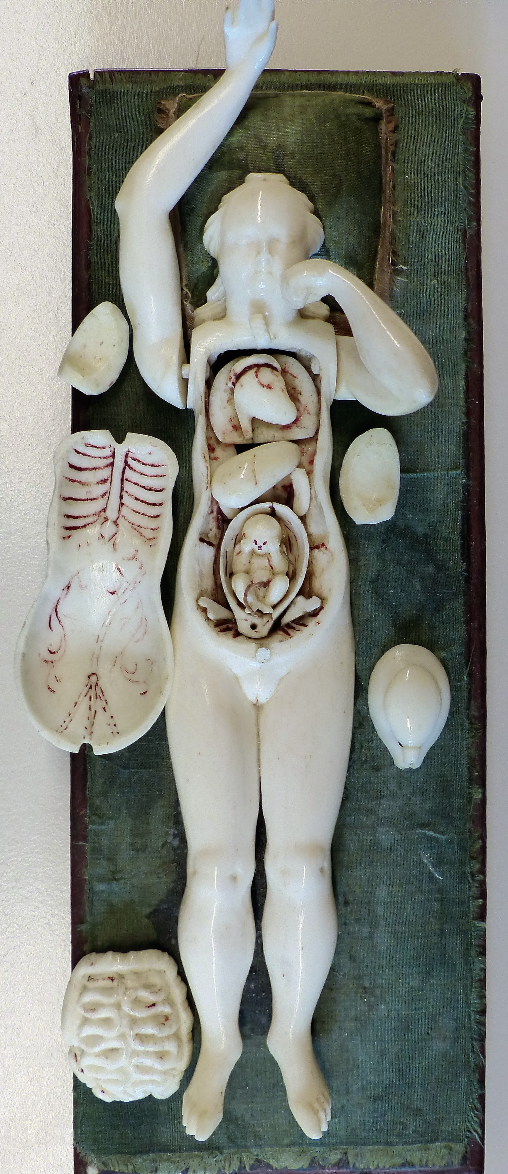 Elfenbeinanatomie einer schwangeren Frau (Museum - Naturalienkabinett Waldenburg CC BY-NC-SA)