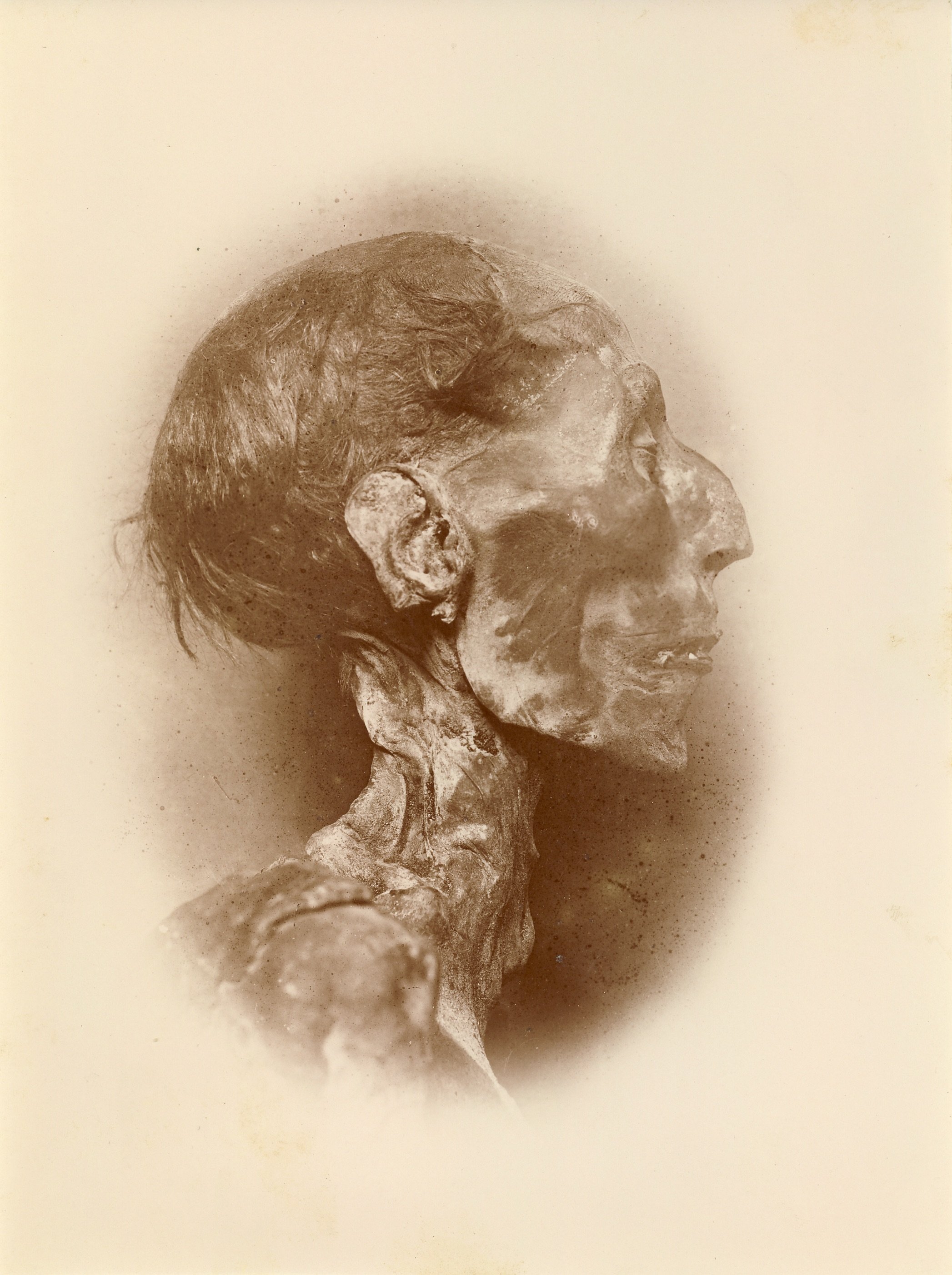 Fotografie Ramses II Kopf der Mumie (Museum - Naturalienkabinett Waldenburg CC BY-NC-SA)
