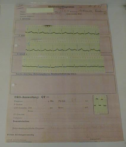 Elektrokardiogramm (Medizinhistorische Sammlungen CC BY-NC-SA)